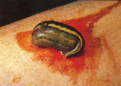 The dreaded leech. Very common. 20 per day per soldier not unusual.